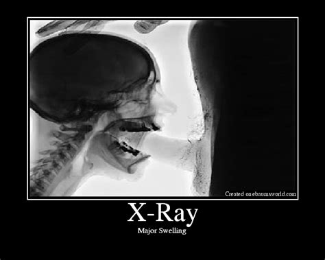 blowjob xray|Blowjob Xray Porn Videos .